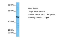 Heparan Sulfate 6-O-Sulfotransferase 2/HS6ST2 Antibody, Novus Biologicals
